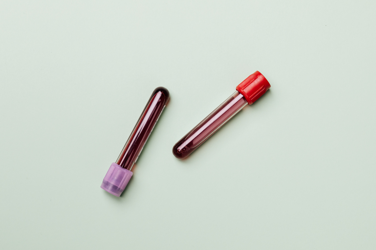 Private Blood Tests Manchester