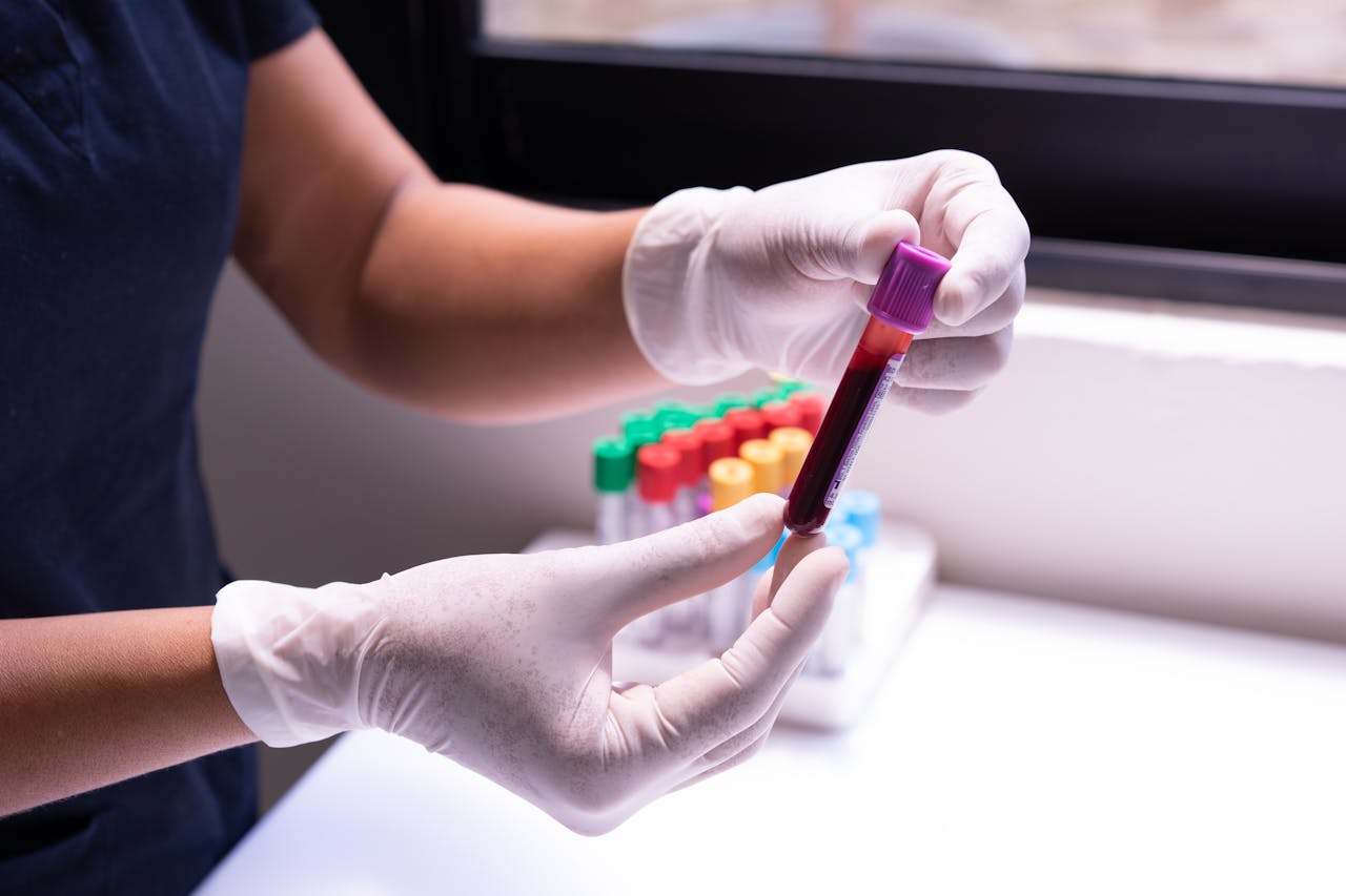 Individual Blood Tests